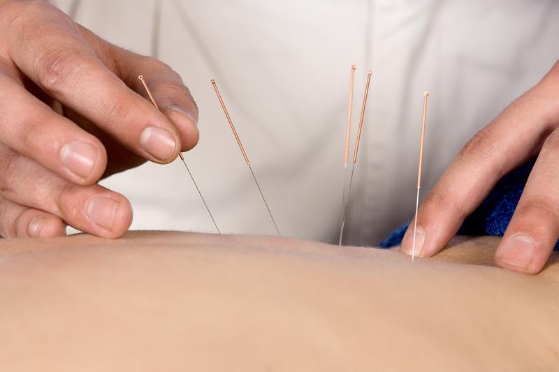 Massage and Acupuncture: A Powerful Combination for Healing